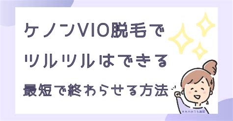 ケノンVIO脱毛でツルツル。全剃り25回で完了できた。